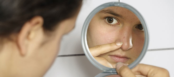 Resultado de imagen para acné en adolescentes